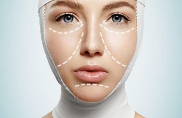 Benefícios da Cirurgia Ortognática