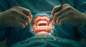 Cirurgia Buco Maxilo