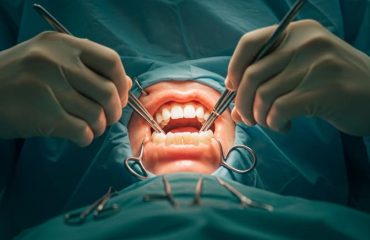 Cirurgia Buco Maxilo