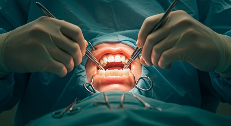 5 Principais Vantagens da Cirurgia Buco Maxilo no Instituto INCOM: Como é Feita, Benefícios e Resultados Cirurgia Buco