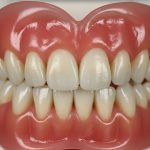Protese de Silicone Dentaria