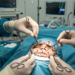 5 Tratamentos Eficazes para Fratura no Rosto - Instituto INCOM fratura no rosto