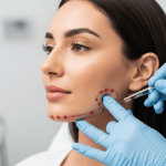 Harmonização Facial no Instituto INCOM 2026: Tendências, Benefícios e Resultados Harmonizacao Facial