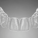 Invisalign Antes e Depois: Resultados Reais no Instituto INCOM aporelho dental Invisalign