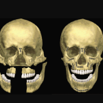 Fratura de Face: 7 Sinais de Alerta e Quando Procurar o Instituto INCOM Cirurgia de Face