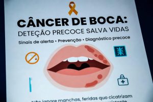 Câncer de Boca