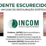 Dente Escurecido